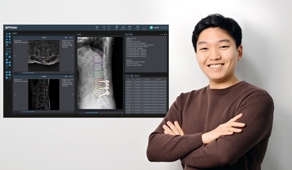 [서강대학교 캠퍼스타운 스타트업 CEO] 척추 질환 진단과 치료를 혁신하는 Me... - 뉴스 썸네일 이미지